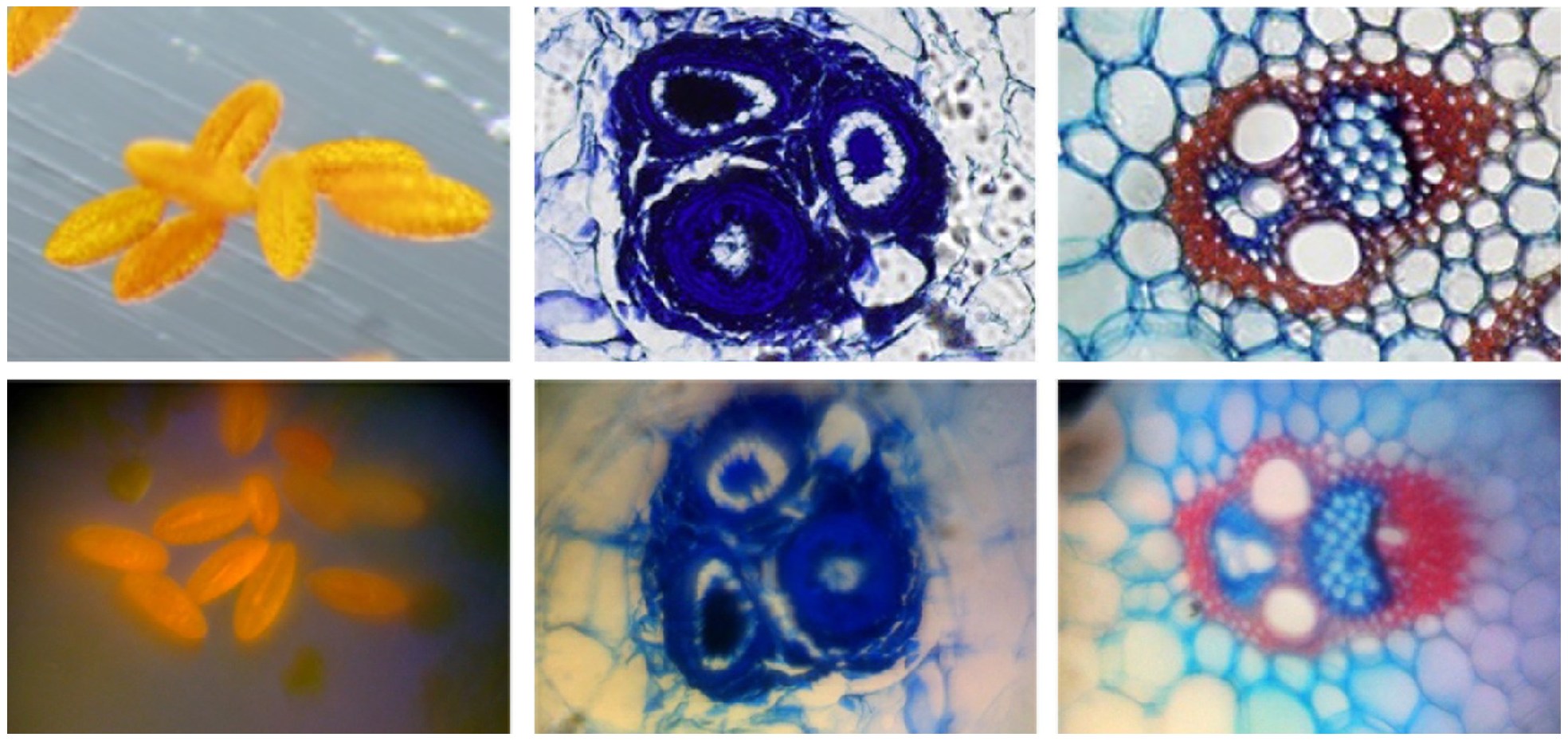 Trasformare l’iPhone in un microscopio